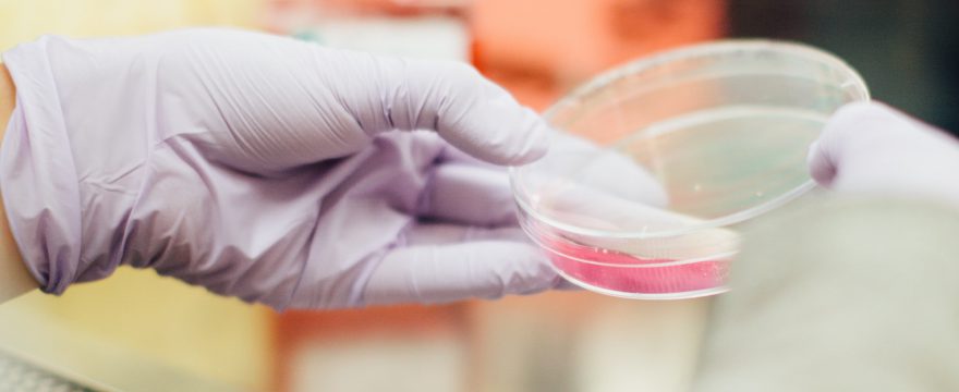 Candida albicans Infektion loswerden mit diesen Tipps (Meine Erfahrungen)